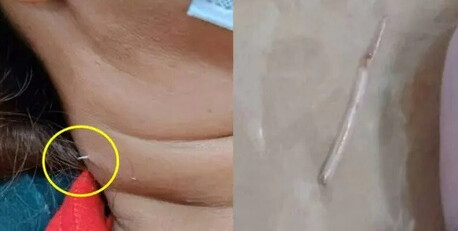 thumbimg