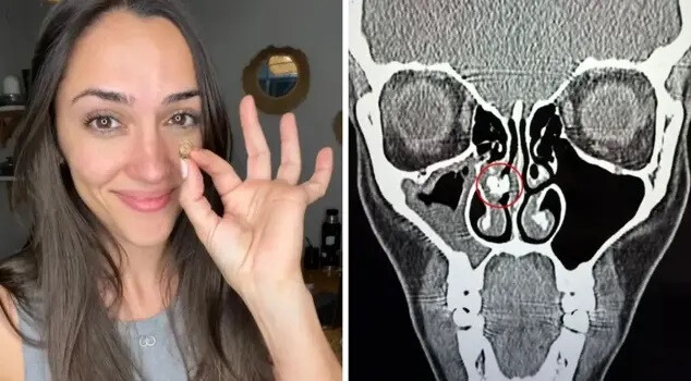 Mystery Solved After...