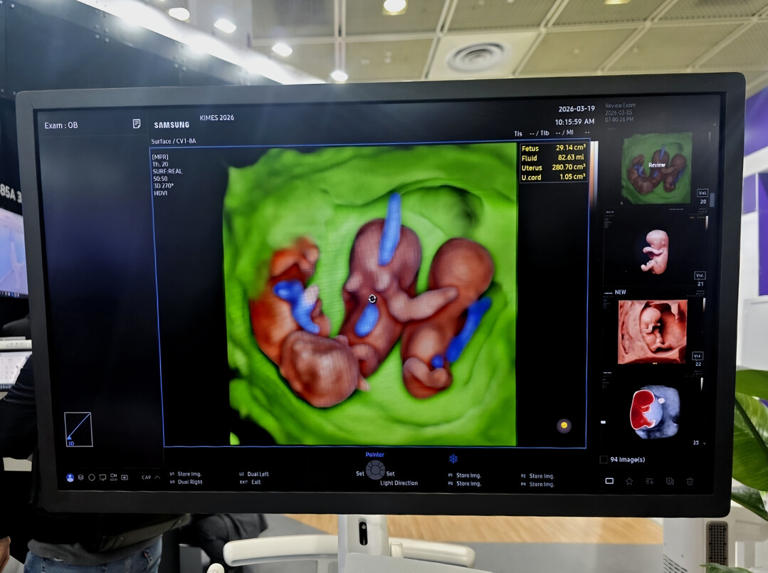 AI Medical Ecosystem in Focus: KIMES 2026 Opens in Seoul as Global Healthcare Hub